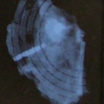 X-ray recording